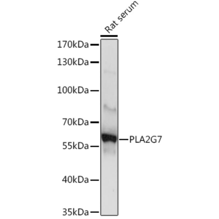 Western Blot - Anti-PLA2G7 Antibody (A10799) - Antibodies.com