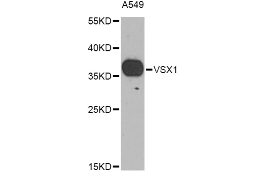 Western Blot - Anti-VSX1 Antibody (A9800) - Antibodies.com