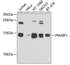 Western Blot - Anti-Noxa Antibody (A10802) - Antibodies.com