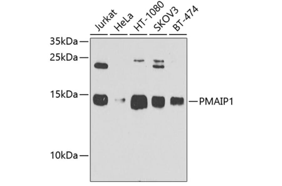 Western Blot - Anti-Noxa Antibody (A10802) - Antibodies.com