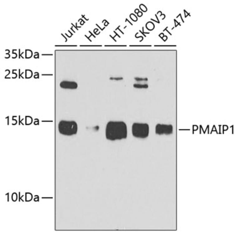 Western Blot - Anti-Noxa Antibody (A10802) - Antibodies.com
