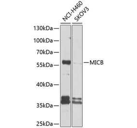 Western Blot - Anti-MICB Antibody (A10803) - Antibodies.com