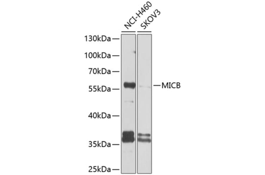 Western Blot - Anti-MICB Antibody (A10803) - Antibodies.com