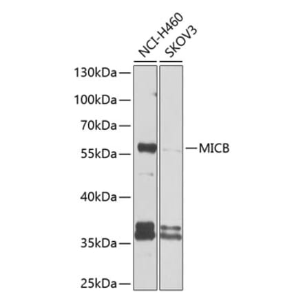 Western Blot - Anti-MICB Antibody (A10803) - Antibodies.com