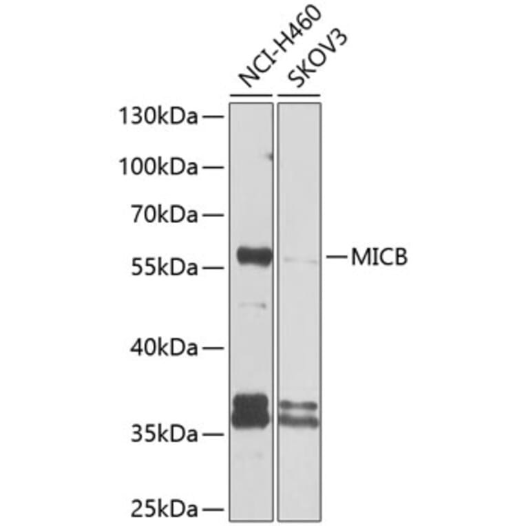 Western Blot - Anti-MICB Antibody (A10803) - Antibodies.com