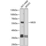 Western Blot - Anti-MICB Antibody (A10803) - Antibodies.com