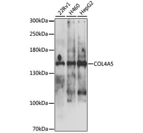 Western Blot - Anti-Collagen IV Antibody (A10804) - Antibodies.com