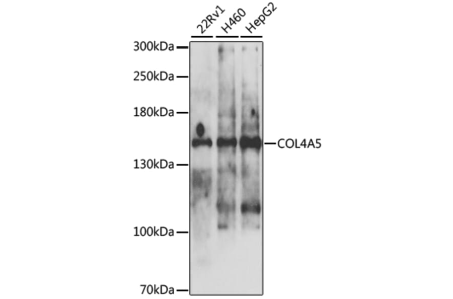 Western Blot - Anti-Collagen IV Antibody (A10804) - Antibodies.com