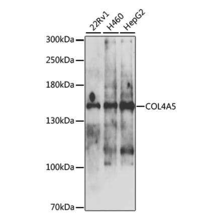 Western Blot - Anti-Collagen IV Antibody (A10804) - Antibodies.com