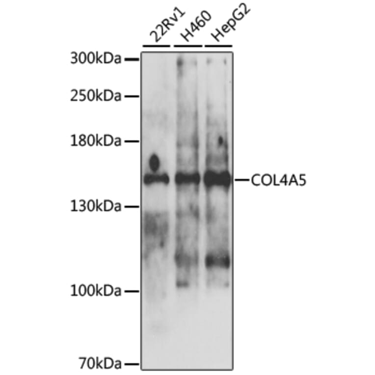 Western Blot - Anti-Collagen IV Antibody (A10804) - Antibodies.com