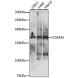 Western Blot - Anti-Collagen IV Antibody (A10804) - Antibodies.com