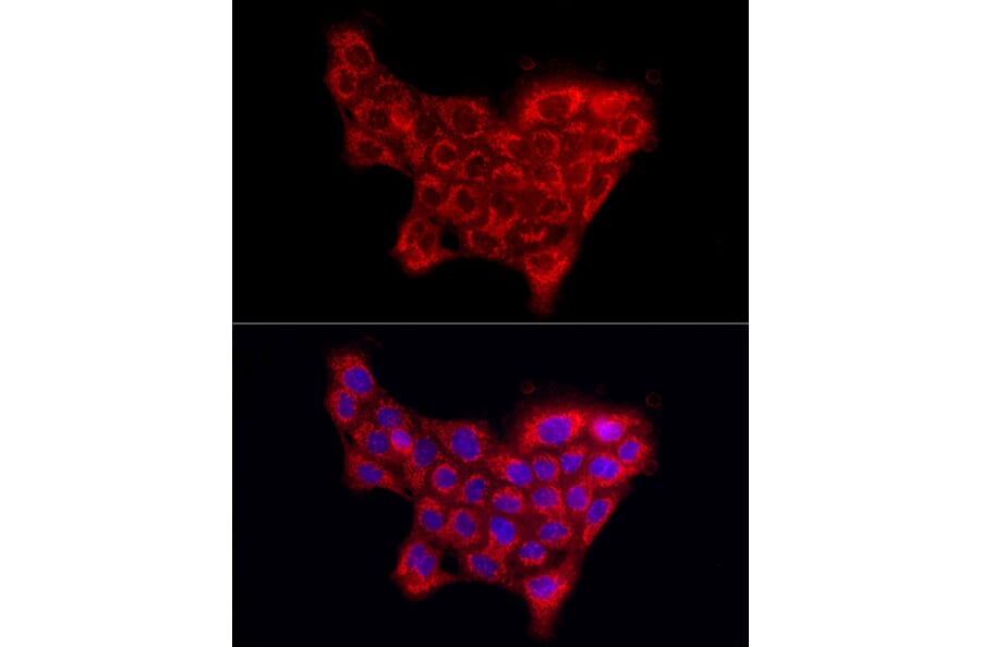 Immunofluorescence - Anti-Collagen IV Antibody (A10804) - Antibodies.com