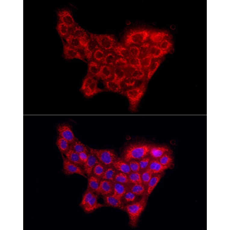 Immunofluorescence - Anti-Collagen IV Antibody (A10804) - Antibodies.com