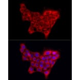 Immunofluorescence - Anti-Collagen IV Antibody (A10804) - Antibodies.com