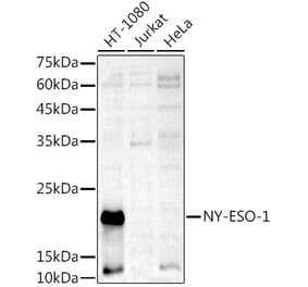 Western Blot - Anti-CTAG1B Antibody (A10805) - Antibodies.com