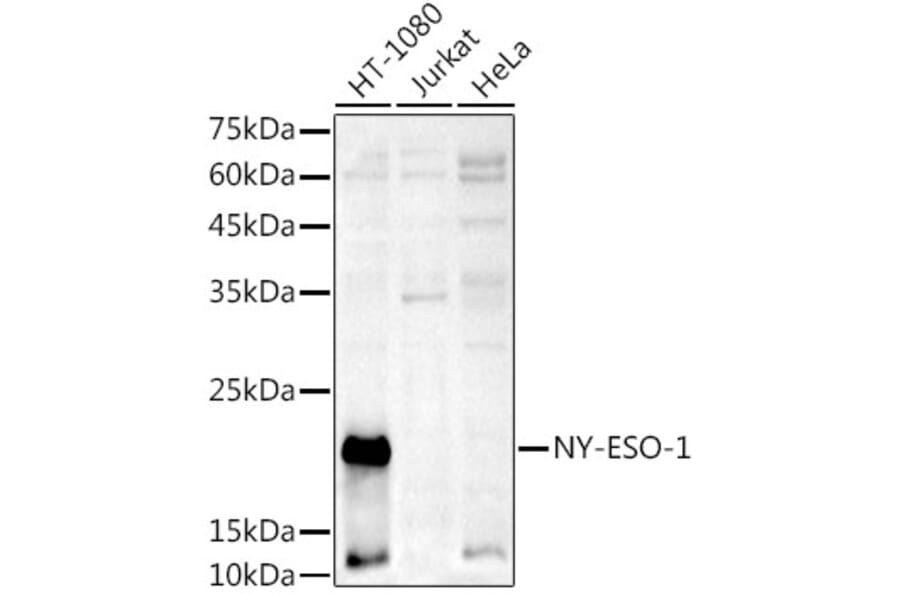 Western Blot - Anti-CTAG1B Antibody (A10805) - Antibodies.com