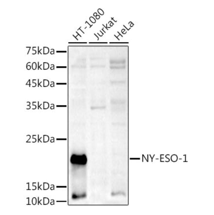 Western Blot - Anti-CTAG1B Antibody (A10805) - Antibodies.com