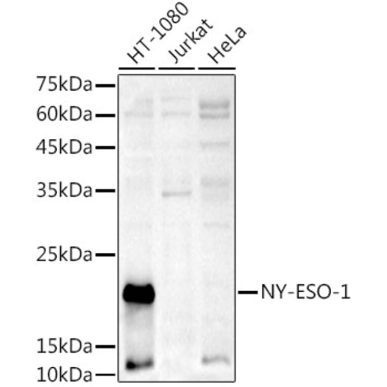 Western Blot - Anti-CTAG1B Antibody (A10805) - Antibodies.com