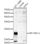 Western Blot - Anti-CTAG1B Antibody (A10805) - Antibodies.com