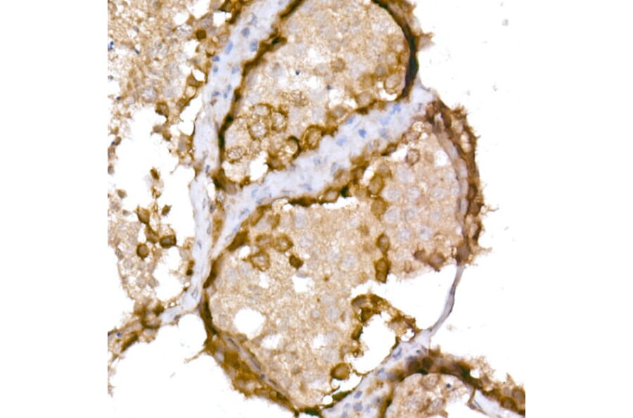 Immunohistochemistry - Anti-CTAG1B Antibody (A10805) - Antibodies.com