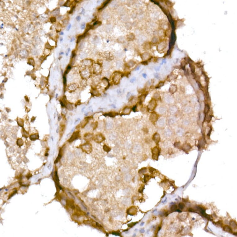 Immunohistochemistry - Anti-CTAG1B Antibody (A10805) - Antibodies.com