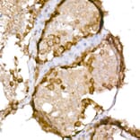 Immunohistochemistry - Anti-CTAG1B Antibody (A10805) - Antibodies.com