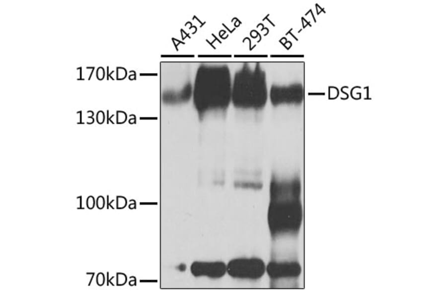 Western Blot - Anti-Desmoglein 1/DSG1 Antibody (A10806) - Antibodies.com