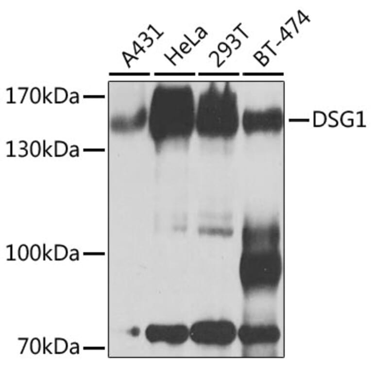 Western Blot - Anti-Desmoglein 1/DSG1 Antibody (A10806) - Antibodies.com