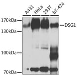 Western Blot - Anti-Desmoglein 1/DSG1 Antibody (A10806) - Antibodies.com