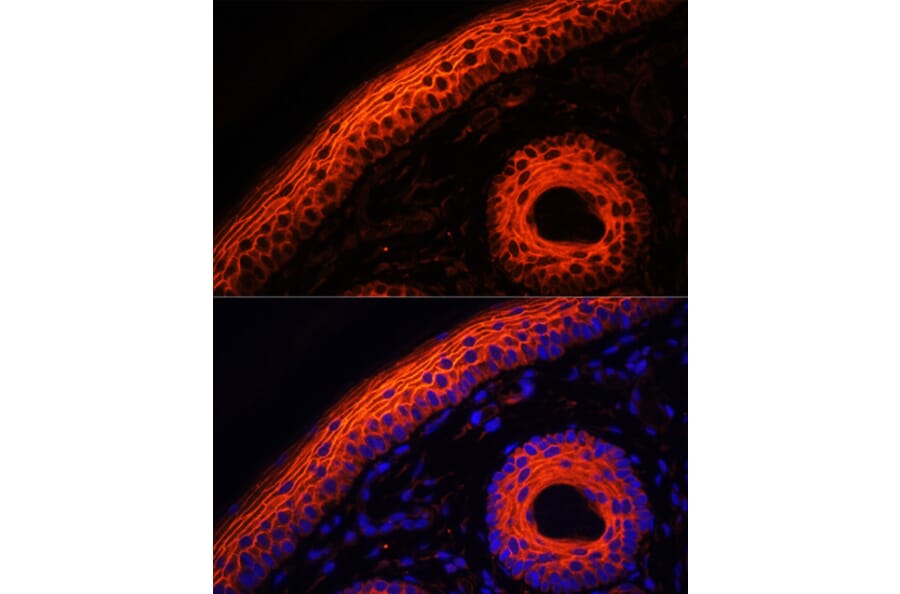 Immunofluorescence - Anti-Desmoglein 1/DSG1 Antibody (A10806) - Antibodies.com