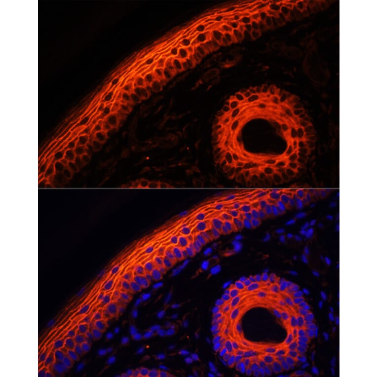 Immunofluorescence - Anti-Desmoglein 1/DSG1 Antibody (A10806) - Antibodies.com
