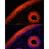 Immunofluorescence - Anti-Desmoglein 1/DSG1 Antibody (A10806) - Antibodies.com