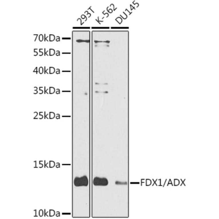 Western Blot - Anti-ADX Antibody (A10807) - Antibodies.com