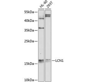 Western Blot - Anti-LCN1 Antibody (A10808) - Antibodies.com