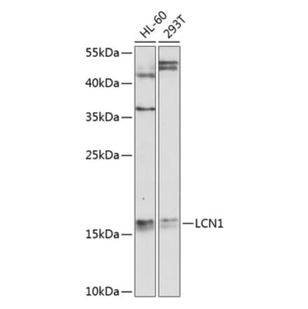 Western Blot - Anti-LCN1 Antibody (A10808) - Antibodies.com