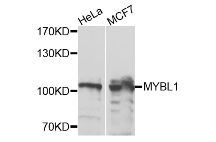 Western Blot - Anti-MYBL1 Antibody (A9829) - Antibodies.com