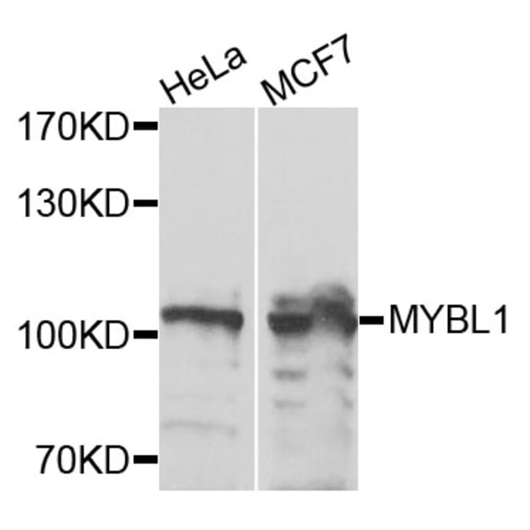 Western Blot - Anti-MYBL1 Antibody (A9829) - Antibodies.com