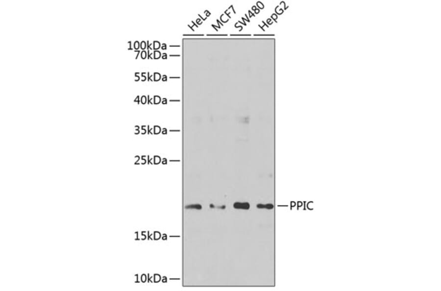 Western Blot - Anti-PPIC Antibody (A10810) - Antibodies.com
