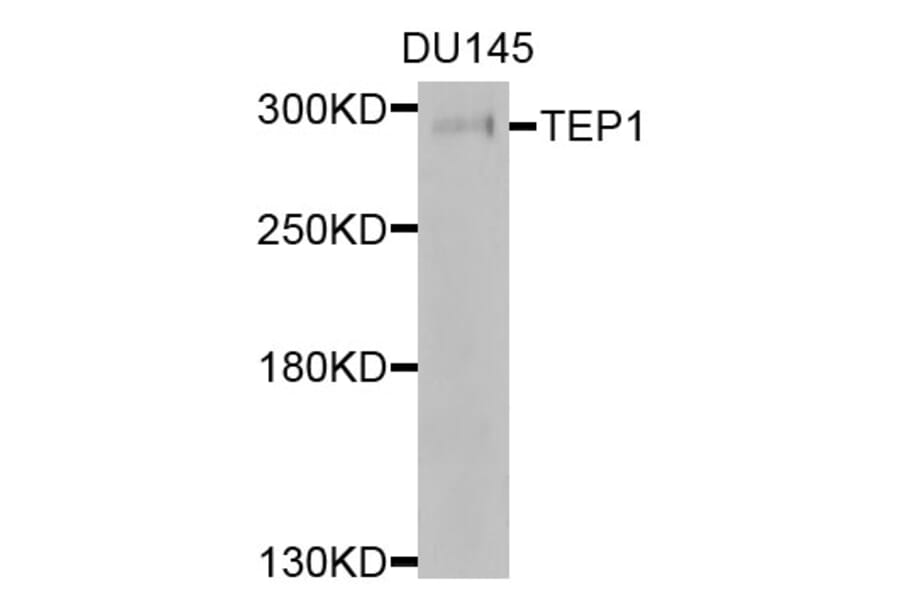 Western Blot - Anti-TEP1 Antibody (A9844) - Antibodies.com