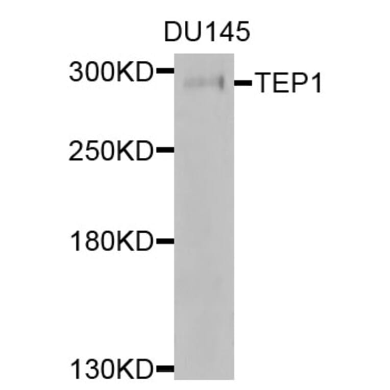 Western Blot - Anti-TEP1 Antibody (A9844) - Antibodies.com