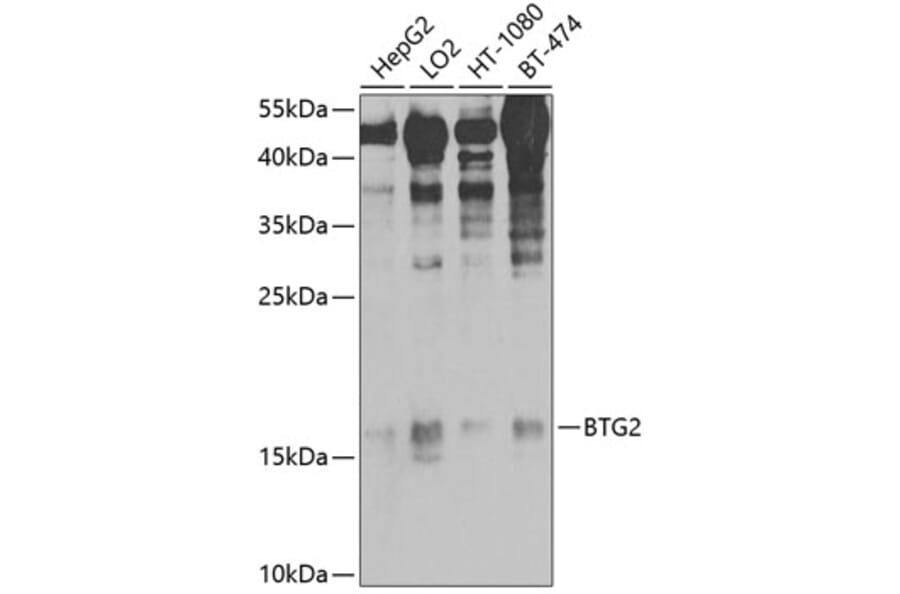Western Blot - Anti-BTG2 / PC3 Antibody (A10812) - Antibodies.com