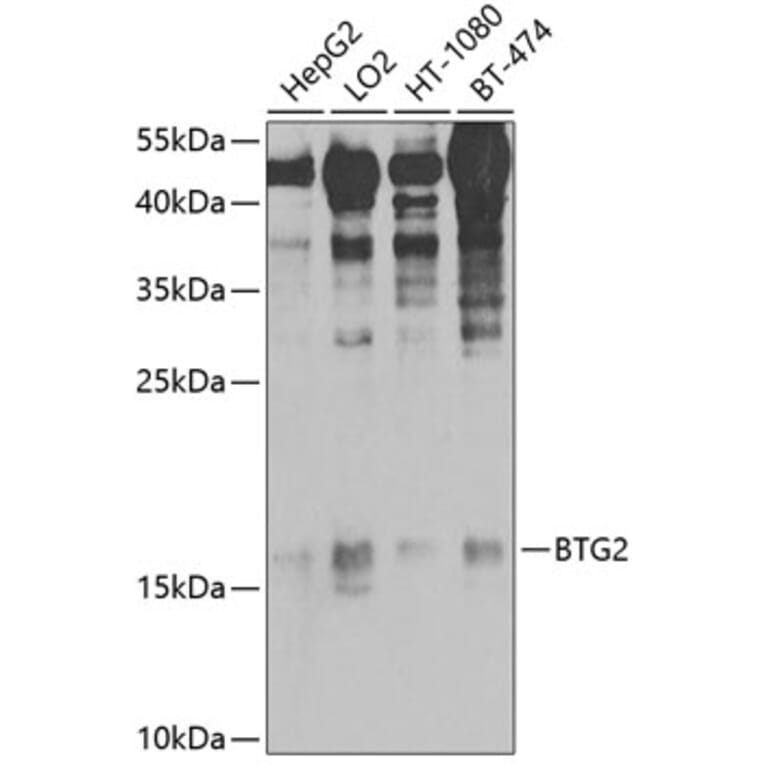 Western Blot - Anti-BTG2 / PC3 Antibody (A10812) - Antibodies.com