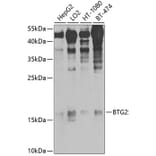 Western Blot - Anti-BTG2 / PC3 Antibody (A10812) - Antibodies.com
