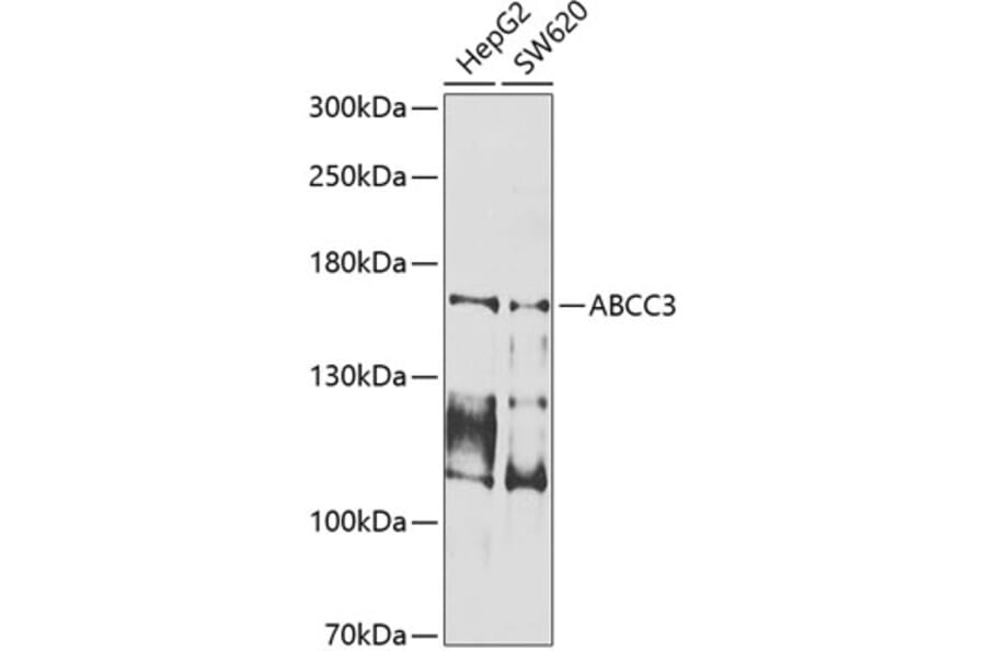 Western Blot - Anti-MRP3 Antibody (A10813) - Antibodies.com
