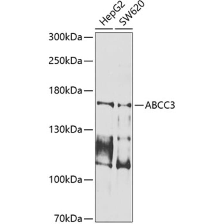 Western Blot - Anti-MRP3 Antibody (A10813) - Antibodies.com