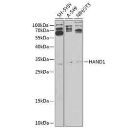 Western Blot - Anti-HAND1 Antibody (A10814) - Antibodies.com