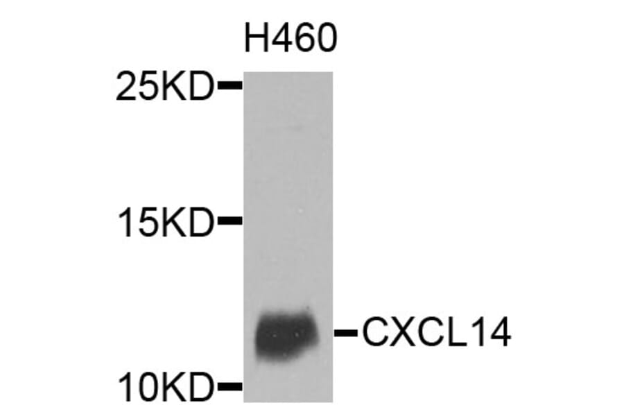 Western Blot - Anti-CXCL14 Antibody (A9857) - Antibodies.com