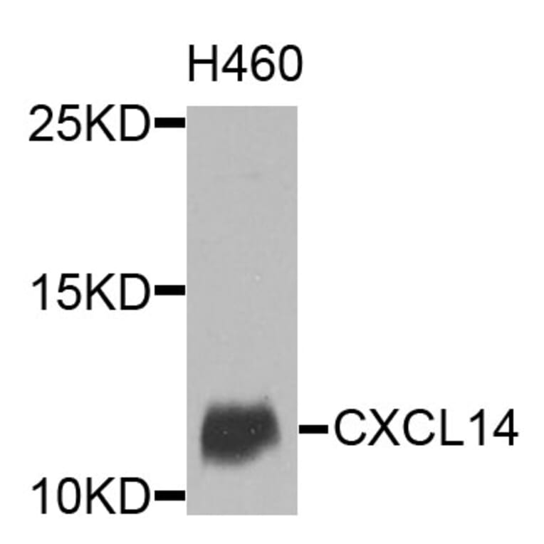 Western Blot - Anti-CXCL14 Antibody (A9857) - Antibodies.com