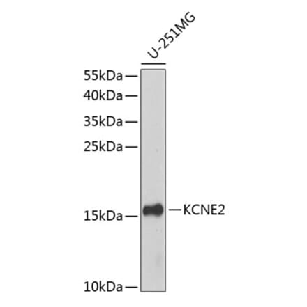 Western Blot - Anti-KCNE2 Antibody (A10817) - Antibodies.com