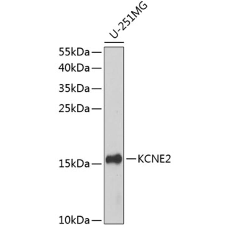 Western Blot - Anti-KCNE2 Antibody (A10817) - Antibodies.com